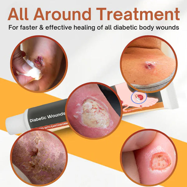 KUBOZN™ Diabetic Wounds Treatment Cream