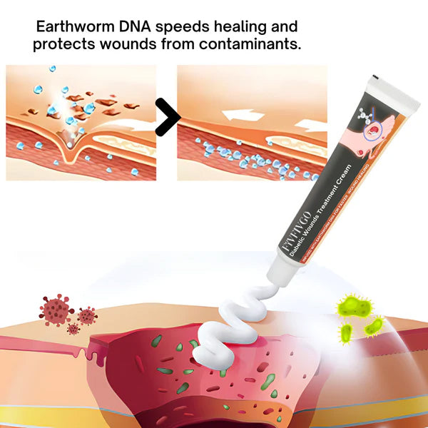 KUBOZN™ Diabetic Wounds Treatment Cream
