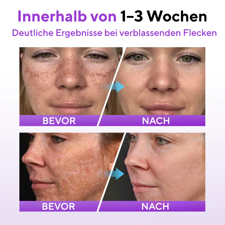 Cvreoz® SpotErase Probiotisches Schutzserum