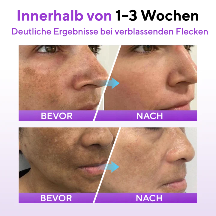 Cvreoz® SpotErase Probiotisches Schutzserum