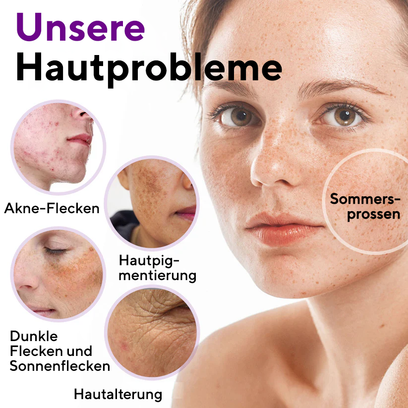 Cvreoz® SpotErase Probiotisches Schutzserum