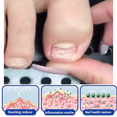 KUBOZN™ Bee Venom Nail Fungus Treatment Solution👣