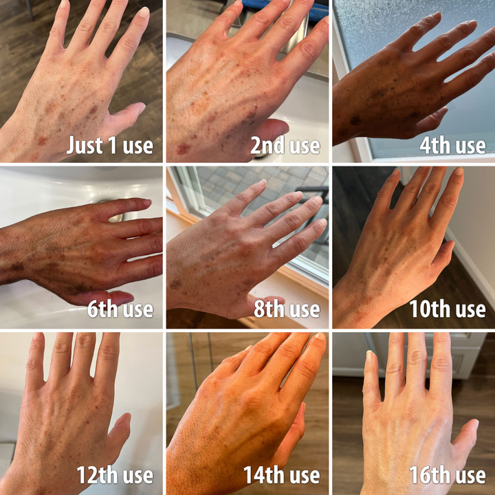 𝑭𝒂𝒔𝒕 𝑫𝒂𝒓𝒌 𝑺𝒑𝒐𝒕 𝑹𝒆𝒎𝒐𝒗𝒆𝒓-𝑨𝑸𝑨™ 𝑵𝒊𝒂𝒄𝒊𝒏𝒂𝒎𝒊𝒅𝒆 𝒂𝒏𝒅 𝑷𝒆𝒂𝒄𝒉 𝑬𝒙𝒕𝒓𝒂𝒄𝒕𝒔