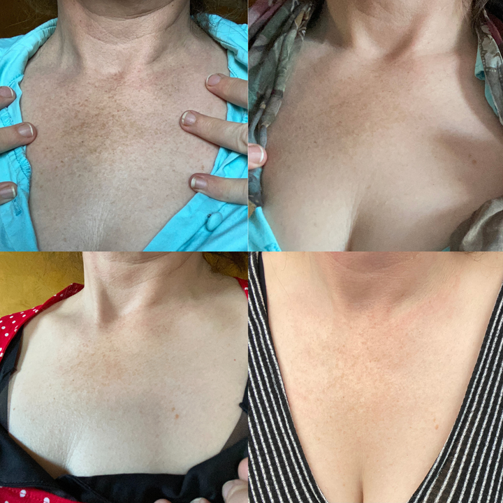 𝑭𝒂𝒔𝒕 𝑫𝒂𝒓𝒌 𝑺𝒑𝒐𝒕 𝑹𝒆𝒎𝒐𝒗𝒆𝒓-𝑨𝑸𝑨™ 𝑵𝒊𝒂𝒄𝒊𝒏𝒂𝒎𝒊𝒅𝒆 𝒂𝒏𝒅 𝑷𝒆𝒂𝒄𝒉 𝑬𝒙𝒕𝒓𝒂𝒄𝒕𝒔