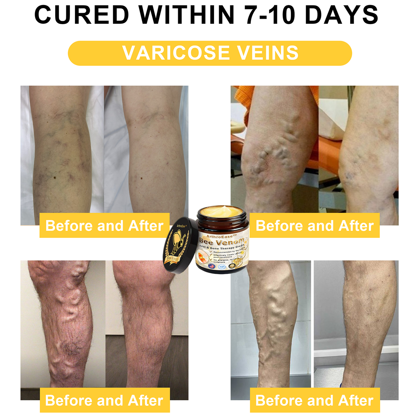Official Store: ArthroEase™ Bee Venom Arthritis Therapy Cream (Joint & Bone Pain Relief in 24 Seconds)