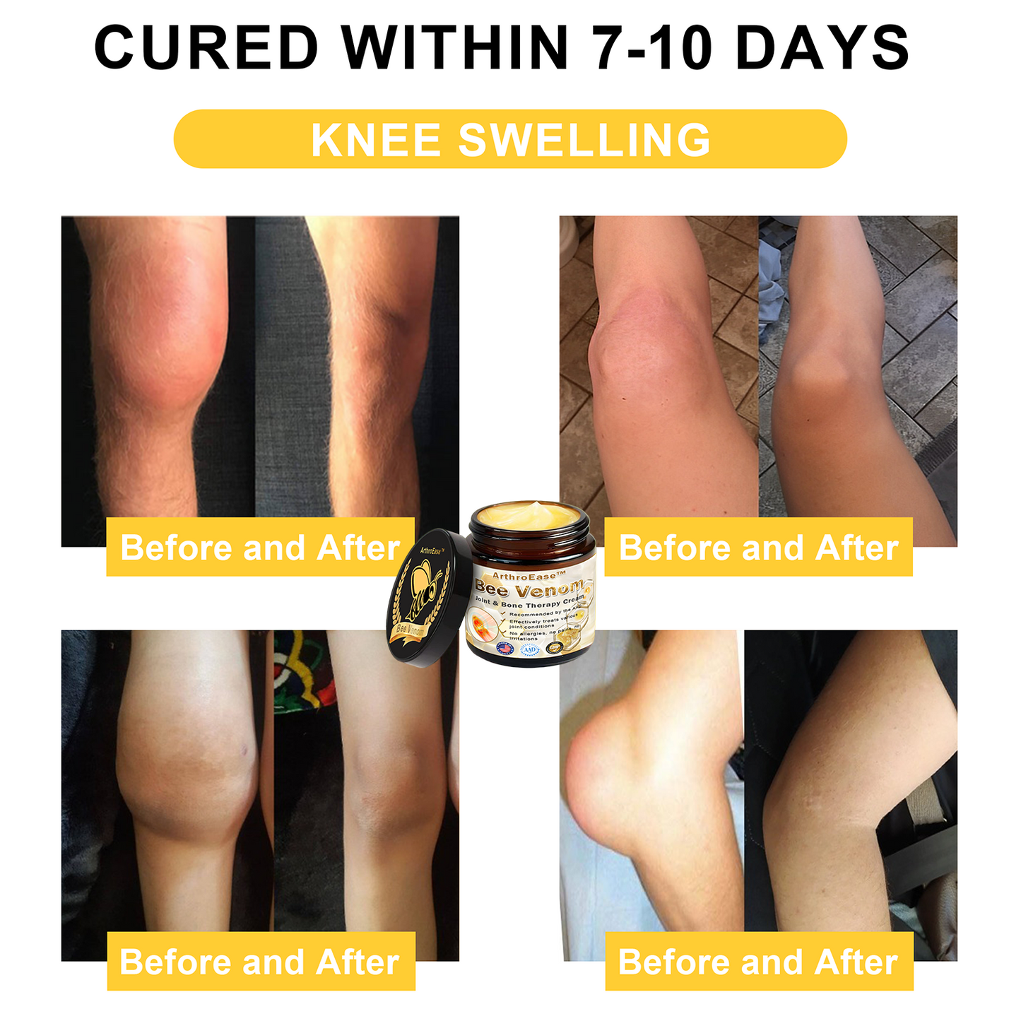 Official Store: ArthroEase™ Bee Venom Arthritis Therapy Cream (Joint & Bone Pain Relief in 24 Seconds)