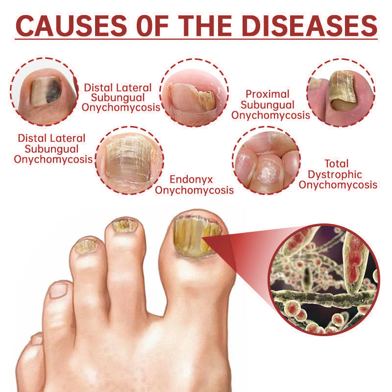 LOVIDS™ Toenail Fungus Treatment | Triple-Action Repair Formula-Plant-Based Formula | FDA-Registered