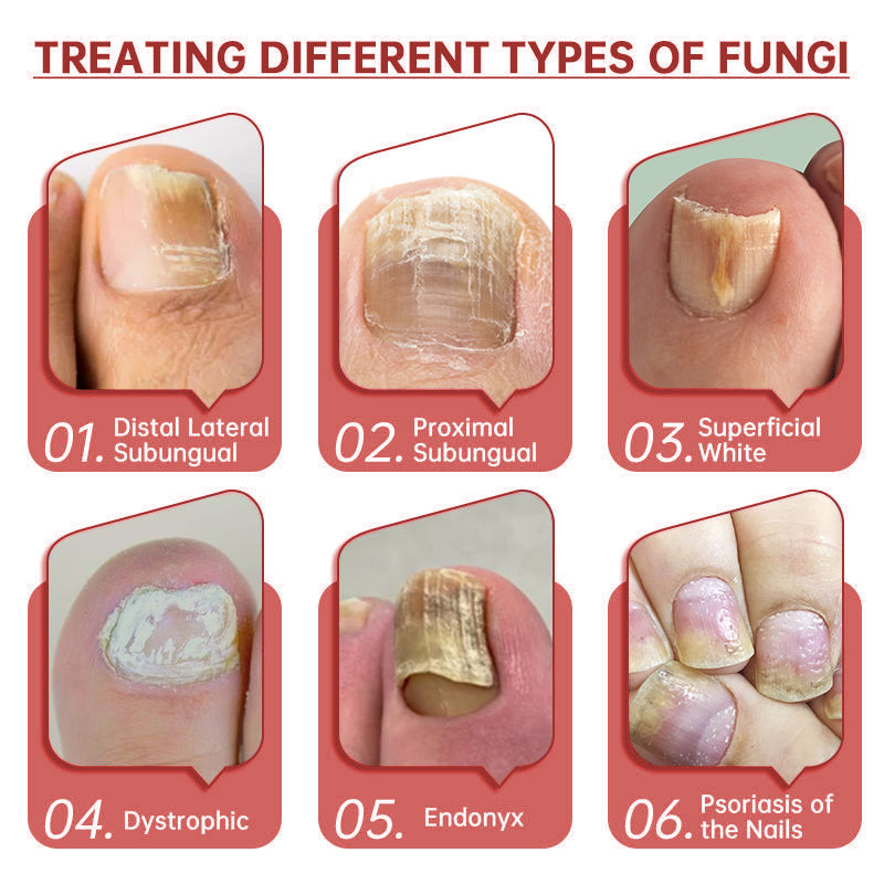 LOVIDS™ Toenail Fungus Treatment | Triple-Action Repair Formula-Plant-Based Formula | FDA-Registered