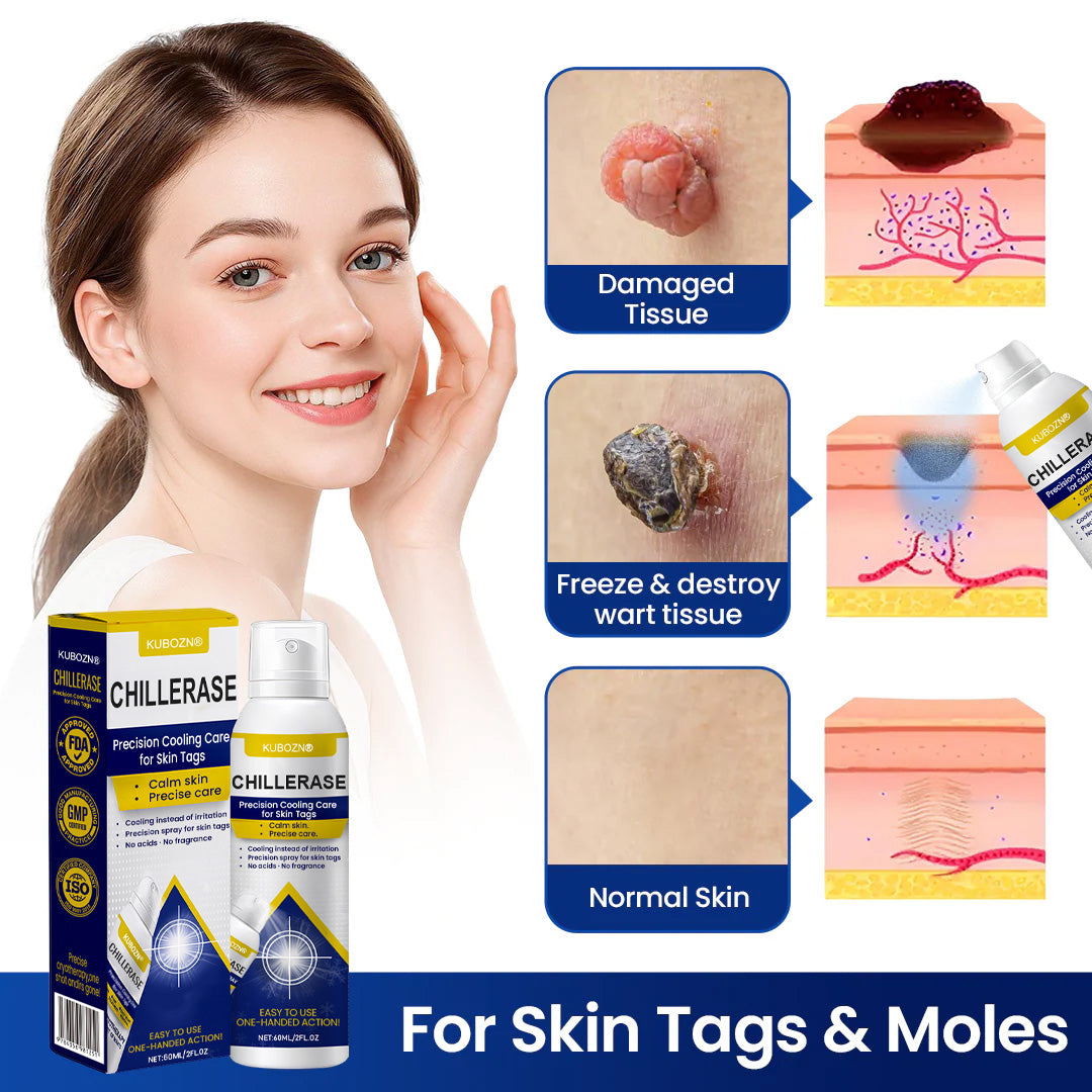 KUBOZN® ChillErase Cooling Spray for Skin Tags