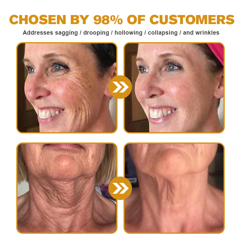 (🔥Made and Shipped from UK✅) Ourlyard® Botox Bee Venom Wrinkle Removal Microdarts Patch- LAST DAY 60% OFF