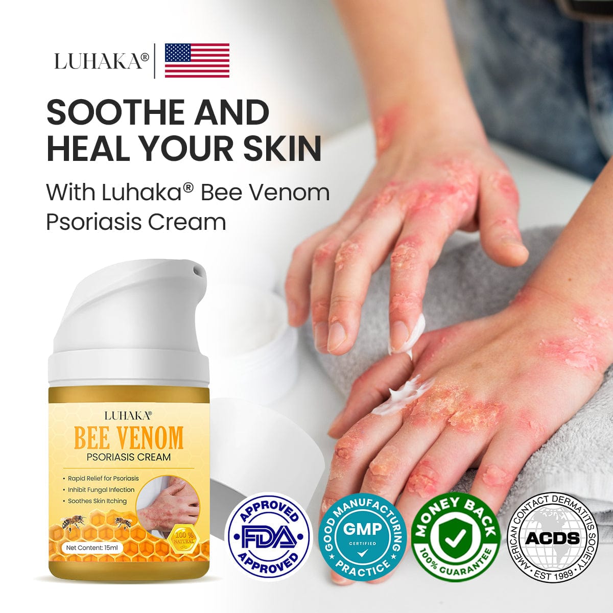 Luhaka® Bee Venom Psoriasis Cream 🐝4