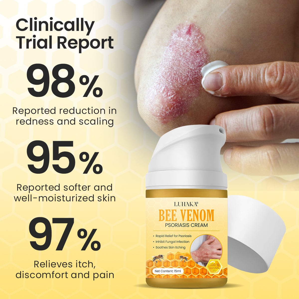 Luhaka® Bee Venom Psoriasis Cream 🐝4