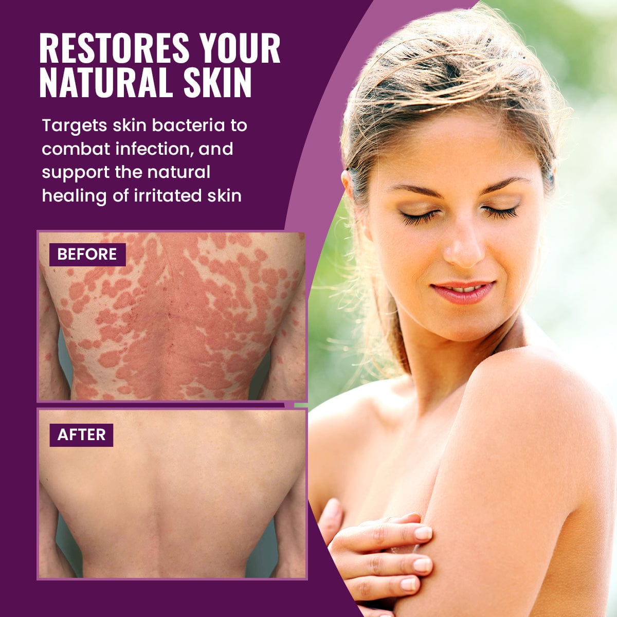 Luhaka™ DermaCure Viola Phillipina Antibacterial Cream_Ultra3