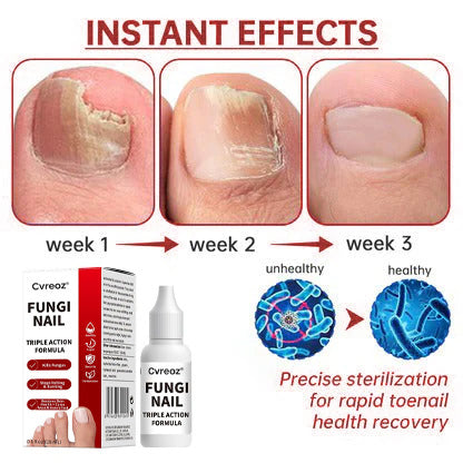 LOVIDS™ Toenail Fungus Treatment | Triple-Action Repair Formula-Plant-Based Formula | FDA-Registered