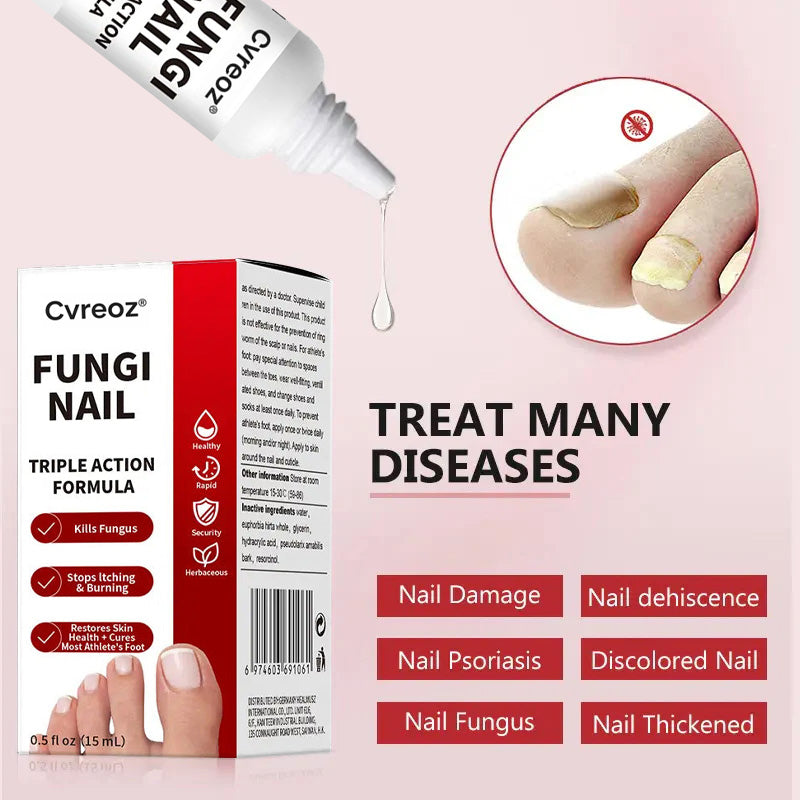 LOVIDS™ Toenail Fungus Treatment | Triple-Action Repair Formula-Plant-Based Formula | FDA-Registered